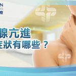 甲狀腺亢進症狀