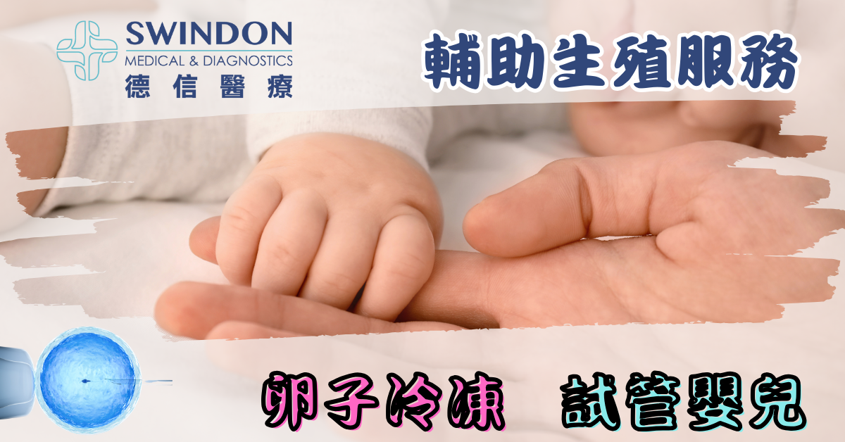 Swindon 凍卵及試管嬰兒